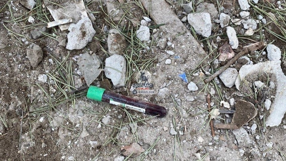 На мусорке рядом с поликлиникой обнаружены пробирки с кровью