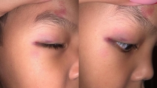 Мама избитого в детсаду мальчика просит проверить воспитателей